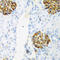 Cysteine And Serine Rich Nuclear Protein 1 antibody, LS-C346243, Lifespan Biosciences, Immunohistochemistry frozen image 
