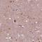 Growth Differentiation Factor 11 antibody, NBP2-57399, Novus Biologicals, Immunohistochemistry frozen image 