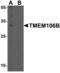 Transmembrane Protein 106B antibody, GTX32067, GeneTex, Western Blot image 