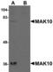N(Alpha)-Acetyltransferase 35, NatC Auxiliary Subunit antibody, A12206, Boster Biological Technology, Western Blot image 