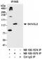 Mtr4 Exosome RNA Helicase antibody, NB100-1575, Novus Biologicals, Immunoprecipitation image 