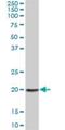 Apolipoprotein B MRNA Editing Enzyme Catalytic Subunit 3H antibody, H00164668-B01P, Novus Biologicals, Western Blot image 