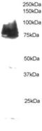 Cortactin antibody, LS-C20146, Lifespan Biosciences, Western Blot image 