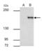 ESET antibody, GTX110219, GeneTex, Immunoprecipitation image 