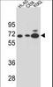 1,4-alpha-D-glucan glucanohydrolase 2B antibody, LS-C156320, Lifespan Biosciences, Western Blot image 