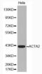 Actin Alpha 2, Smooth Muscle antibody, MBS126139, MyBioSource, Western Blot image 