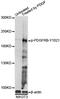 Platelet Derived Growth Factor Receptor Beta antibody, LS-C750620, Lifespan Biosciences, Western Blot image 