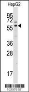 G Protein-Coupled Receptor Kinase 7 antibody, 63-174, ProSci, Western Blot image 