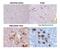 Interleukin 1 Receptor Associated Kinase 4 antibody, DDX0340P-100, Novus Biologicals, Immunohistochemistry paraffin image 