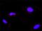 Protein Phosphatase 2 Scaffold Subunit Aalpha antibody, H00005518-M02, Novus Biologicals, Proximity Ligation Assay image 