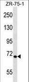 Tyrosine-protein kinase Tec antibody, LS-C161793, Lifespan Biosciences, Western Blot image 