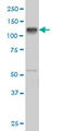 EPH Receptor B3 antibody, LS-C104944, Lifespan Biosciences, Western Blot image 