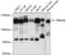 Tripartite Motif Containing 28 antibody, A00409, Boster Biological Technology, Western Blot image 