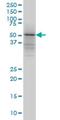 Tripartite Motif Containing 49 antibody, H00057093-M02, Novus Biologicals, Western Blot image 