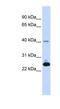 Selenoprotein S antibody, NBP1-59042, Novus Biologicals, Western Blot image 