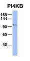 Phosphatidylinositol 4-Kinase Beta antibody, orb326098, Biorbyt, Western Blot image 