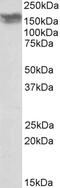 Methylenetetrahydrofolate Dehydrogenase (NADP+ Dependent) 1 Like antibody, 42-396, ProSci, Western Blot image 