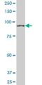 Ring Finger Protein 10 antibody, H00009921-B01P, Novus Biologicals, Western Blot image 