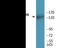 Nitric Oxide Synthase 3 antibody, EKC2316, Boster Biological Technology, Western Blot image 