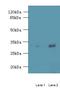 Receptor Transporter Protein 4 antibody, MBS1492809, MyBioSource, Western Blot image 