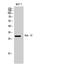 RAB18, Member RAS Oncogene Family antibody, A03719, Boster Biological Technology, Western Blot image 