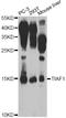 TGFB1-Induced Anti-Apoptotic Factor 1 antibody, STJ110073, St John