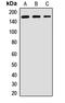 AF4/FMR2 Family Member 4 antibody, LS-C668739, Lifespan Biosciences, Western Blot image 