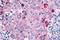 Cell Division Cycle 7 antibody, NLS7980, Novus Biologicals, Immunohistochemistry frozen image 