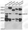 Abhydrolase Domain Containing 5 antibody, A7592, ABclonal Technology, Western Blot image 
