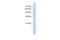 Solute Carrier Family 22 Member 23 antibody, A13567, Boster Biological Technology, Western Blot image 