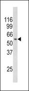 RCC1 And BTB Domain Containing Protein 2 antibody, 62-441, ProSci, Western Blot image 