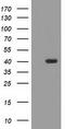 TBC1 Domain Family Member 21 antibody, TA503741, Origene, Western Blot image 