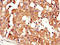 Cellular Retinoic Acid Binding Protein 2 antibody, orb23410, Biorbyt, Immunohistochemistry paraffin image 