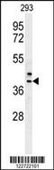 Calcium Modulating Ligand antibody, 62-091, ProSci, Western Blot image 