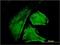 IQ Motif Containing GTPase Activating Protein 1 antibody, H00008826-M01, Novus Biologicals, Immunofluorescence image 