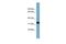 Methionyl Aminopeptidase 1 antibody, PA5-44285, Invitrogen Antibodies, Western Blot image 