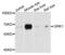 G Protein-Coupled Receptor Kinase 1 antibody, LS-C332301, Lifespan Biosciences, Western Blot image 