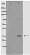 Nerve Growth Factor antibody, TA347902, Origene, Western Blot image 