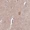Stress Induced Phosphoprotein 1 antibody, NBP2-32621, Novus Biologicals, Immunohistochemistry paraffin image 