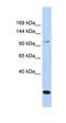 Transient Receptor Potential Cation Channel Subfamily C Member 6 antibody, orb330993, Biorbyt, Western Blot image 