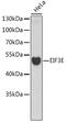 Eukaryotic Translation Initiation Factor 3 Subunit E antibody, 22-145, ProSci, Western Blot image 
