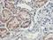 Homeobox C11 antibody, LS-C337298, Lifespan Biosciences, Immunohistochemistry paraffin image 