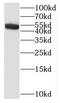 Interleukin 17 Receptor C antibody, FNab04231, FineTest, Western Blot image 
