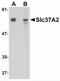 Solute Carrier Family 37 Member 2 antibody, NBP1-77132, Novus Biologicals, Western Blot image 