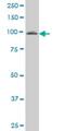 Vav Guanine Nucleotide Exchange Factor 1 antibody, H00007409-M04, Novus Biologicals, Western Blot image 