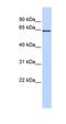 Monoamine Oxidase B antibody, orb330315, Biorbyt, Western Blot image 