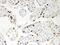Poly(ADP-Ribose) Polymerase 1 antibody, PB9309, Boster Biological Technology, Immunohistochemistry paraffin image 