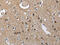 CD160 Molecule antibody, CSB-PA974344, Cusabio, Immunohistochemistry paraffin image 