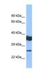 Lysophospholipase Like 1 antibody, orb331336, Biorbyt, Western Blot image 