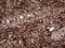 Transaldolase 1 antibody, LS-C792249, Lifespan Biosciences, Immunohistochemistry paraffin image 